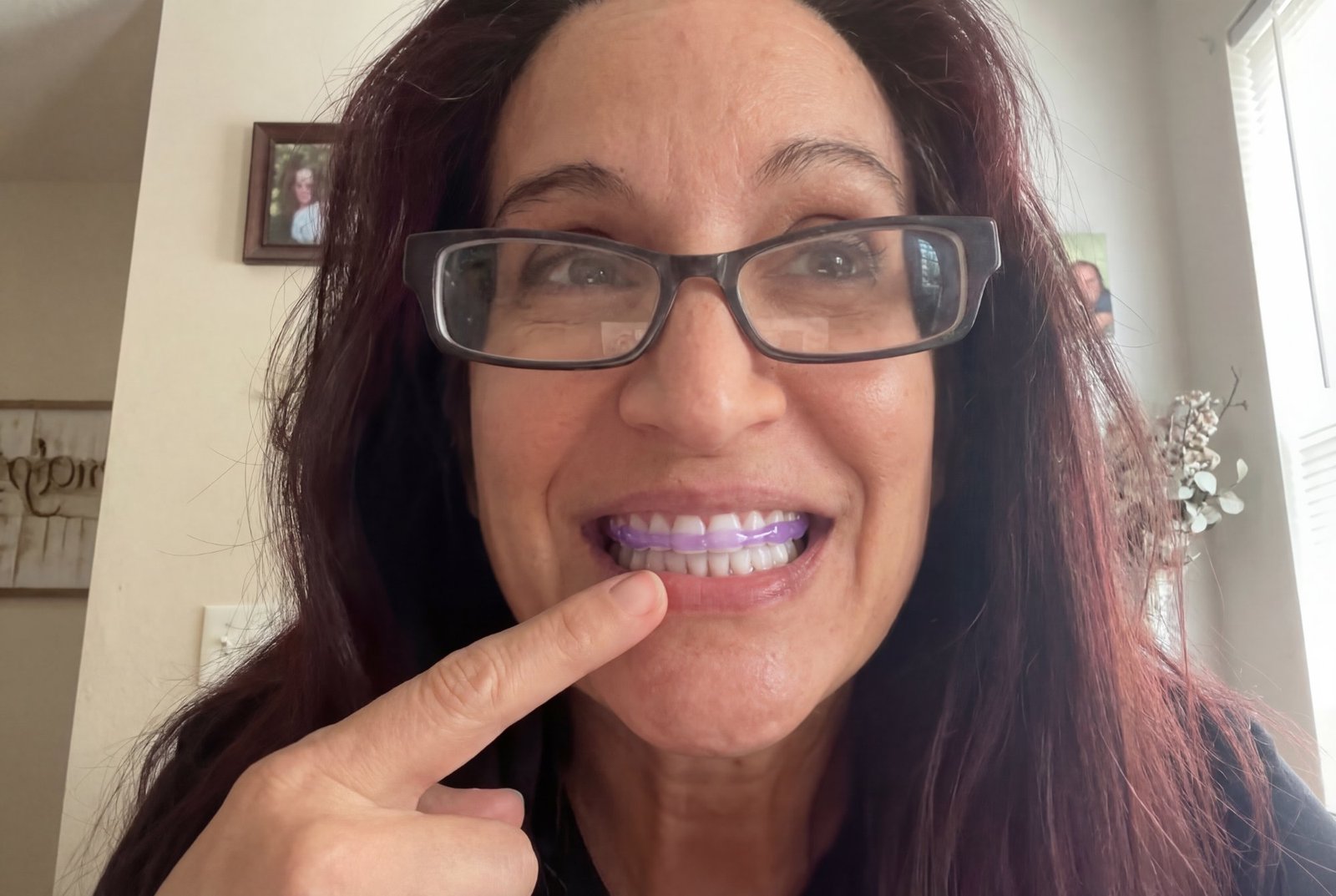 Step 1 — Dry your teeth